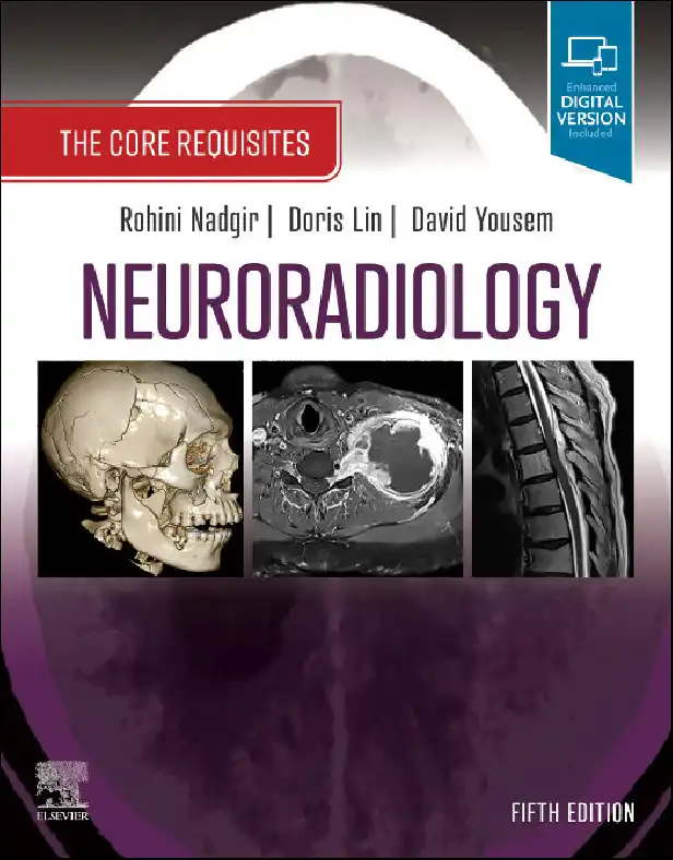 کتاب Neuroradiology